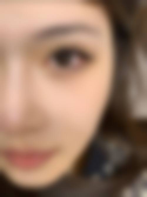 八、杭州昕薇整形美容医院真实的顾客评价如下：