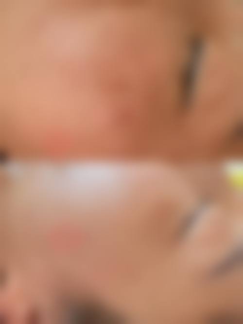五、徐州莱美俪格（原丽珍）美容医院实例