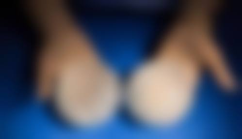 五、鹤壁戴安娜医疗美容门诊部实例