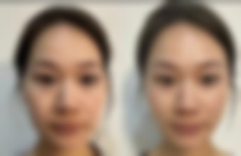 六、杭州昕薇整形美容医院怎么预约：