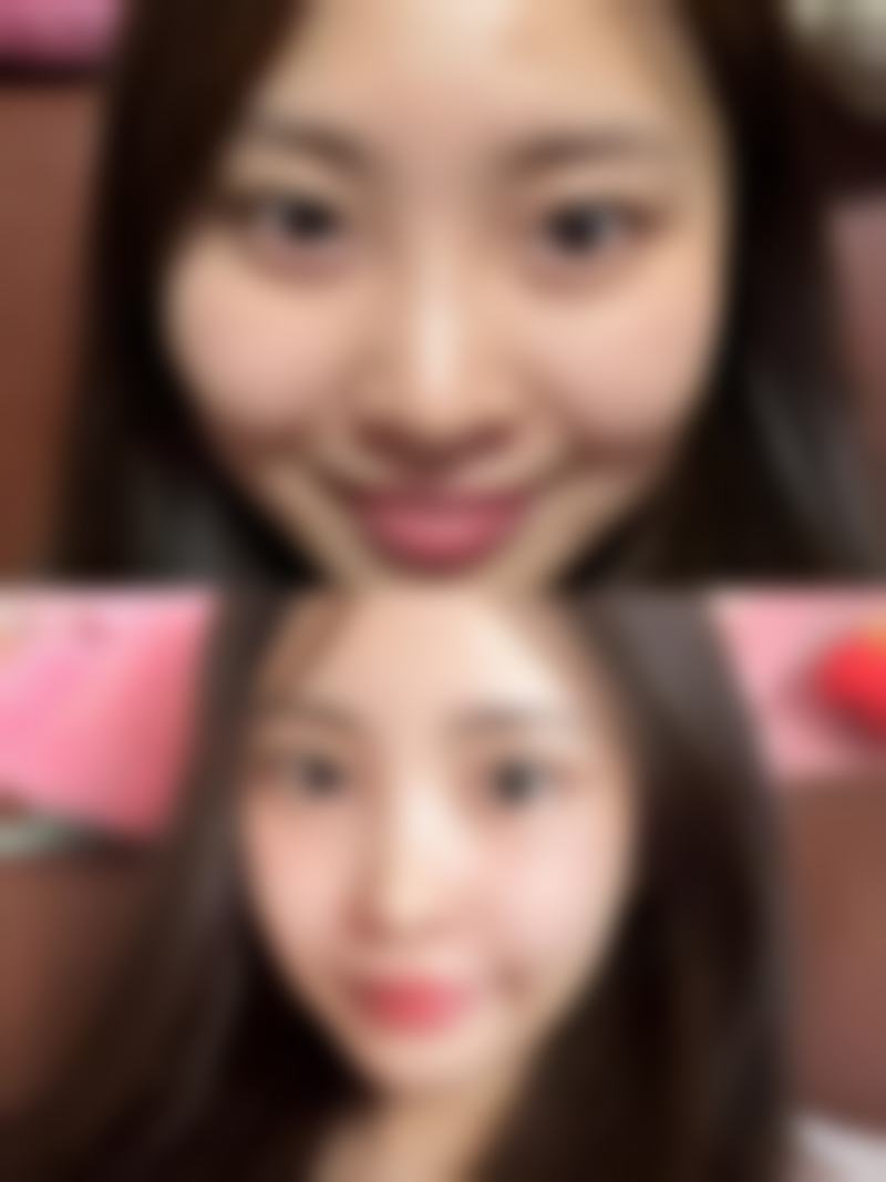五、东莞华美女子国内外整形医学美容中 心实例