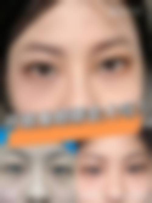 八、北京紫美韵整形医疗美容诊所真实的顾客评价如下: