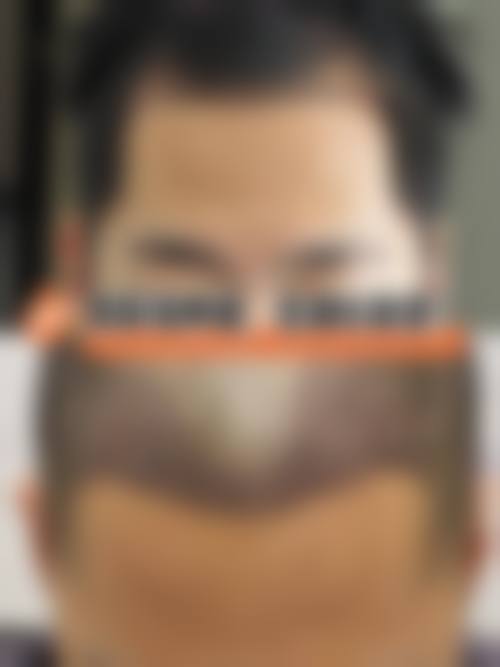 武春燕医生在哪家医院怎么预约？