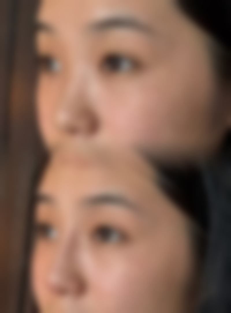 七、秦皇岛潘纳茜医院医疗美容科价格表:(仅供参考)