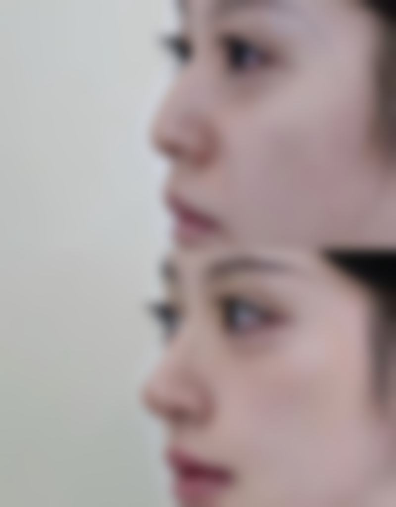 八、瑞恩整形外科真实的顾客评价如下:
