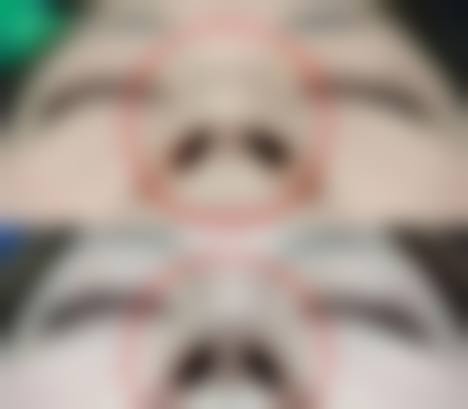 七、北京菁至整形医院价格表：（仅供参考）