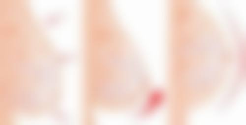 八、甘肃省第三人民医院整形美容科真实的顾客评价如下: