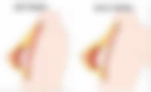 怎样消除眼袋成效好?日常长期改善不可少