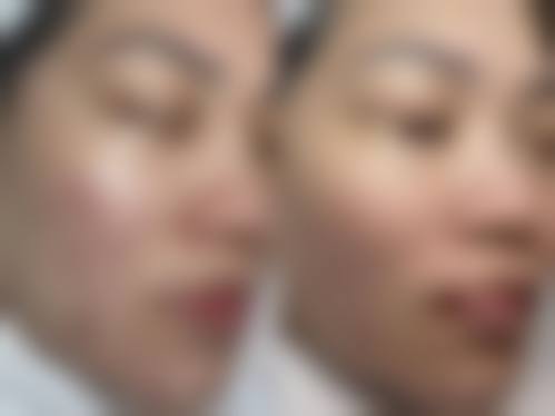曾同祥医生口碑和评价