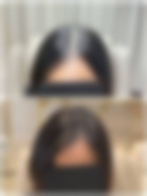 七、绵阳碧莲盛植发医疗美容诊所价格表(仅供参考)