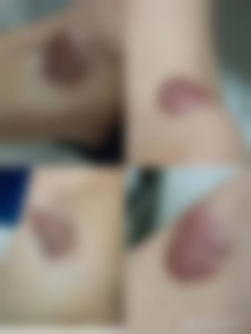 曾同祥医生在哪家医院怎么预约?