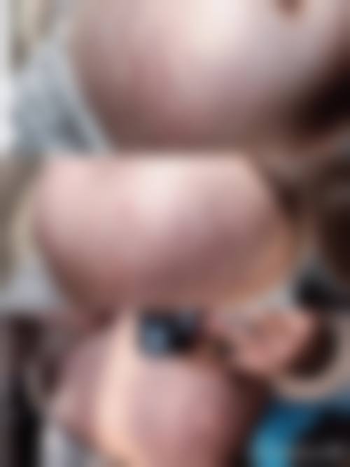 曾同祥医生实例