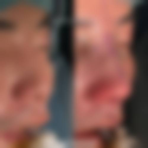 六、青岛东方医学整形美容价格表:(仅供参考)