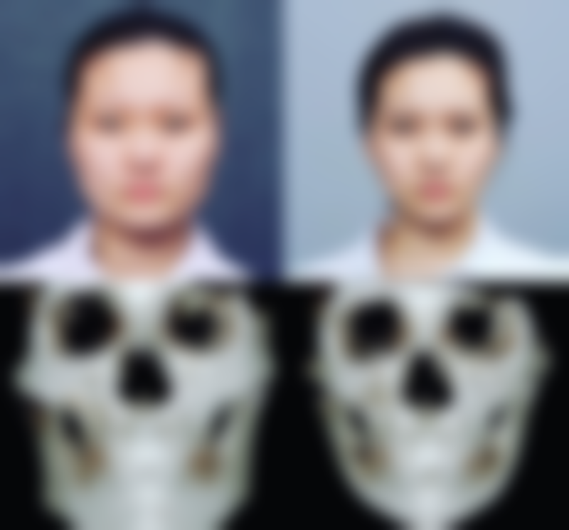 八、绵阳碧莲盛植发医疗美容诊所真实的顾客评价如下