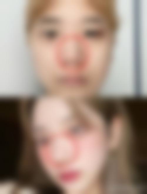 七、哈尔滨伊美瑞尔医疗美容门诊部真实的顾客评价如下: