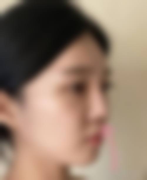 刁良亚医生在哪家医院怎么预约?