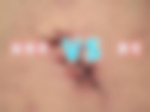 李秀玄医生在哪家医院怎么预约?