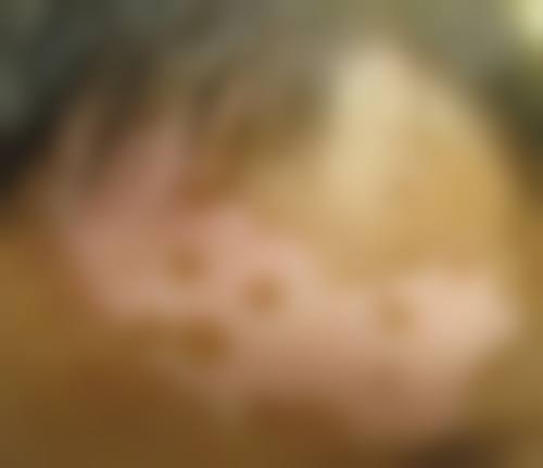 郭远医生在哪家医院怎么预约？
