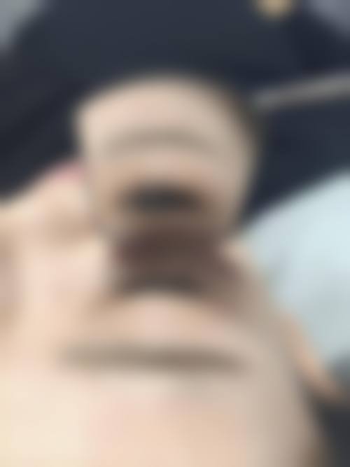 李秀玄医生怎么样可靠吗?