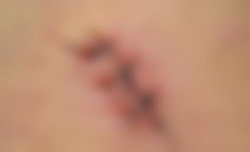 七、马鞍山郁美医疗美容诊所价格表:(仅供参考)