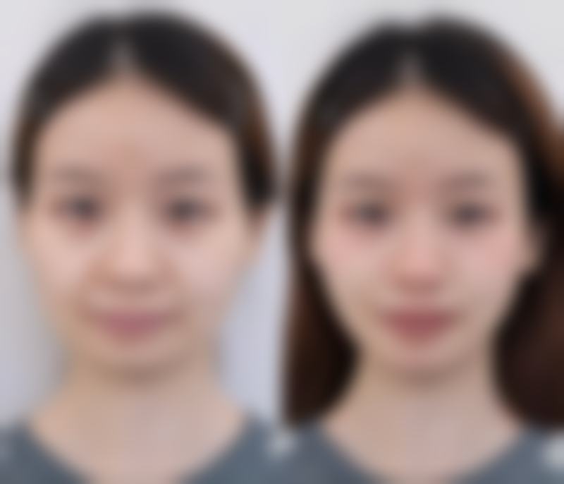 如何精细判定：通过疤痕形态与特征来判断