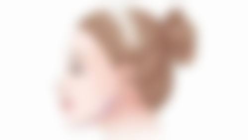 切开双眼皮维持时间的额外注意事项