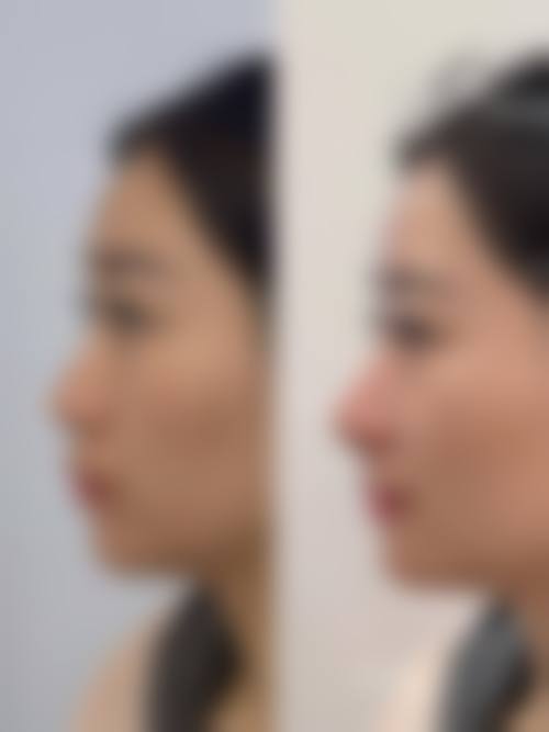 八、贵阳艺龄医疗美容医院真实的顾客评价如下: