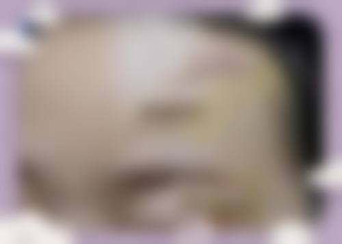三、利辛县人民医院(整形美容外科)医生介绍: