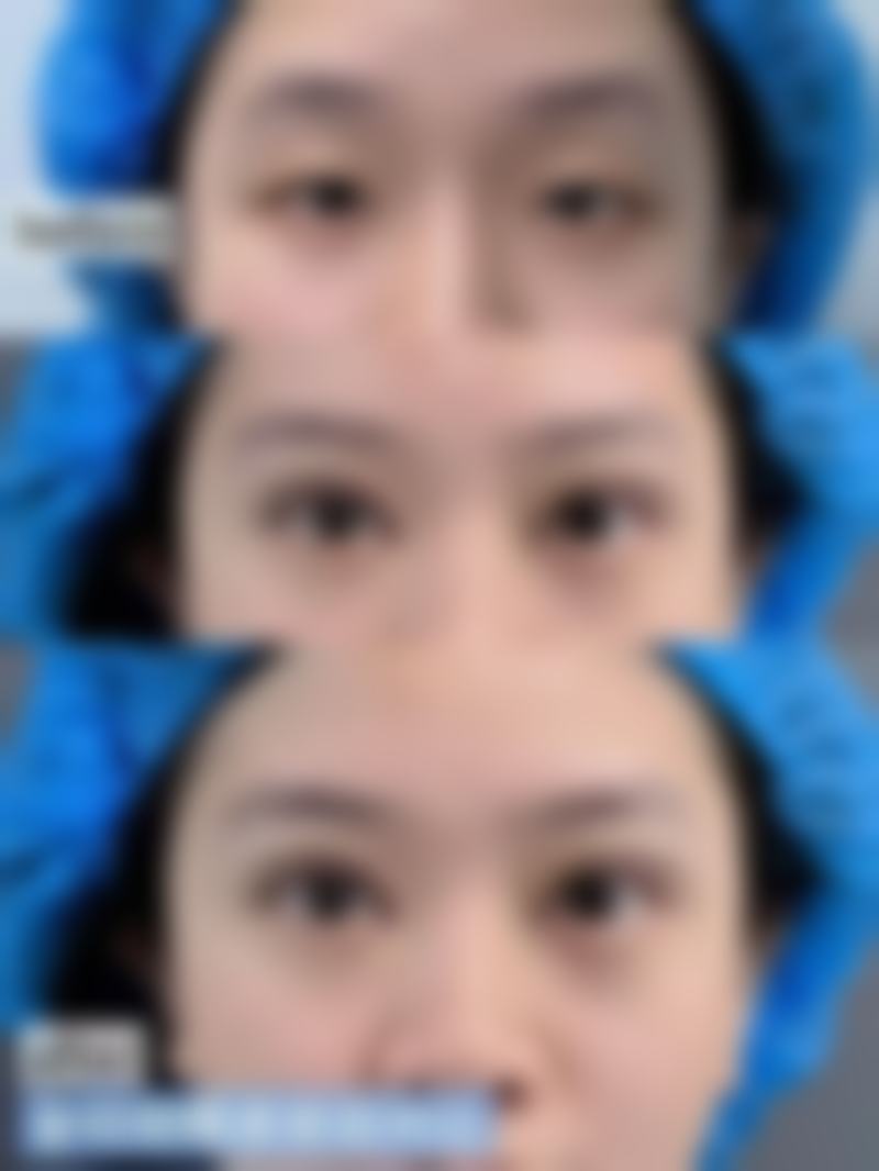 二、利辛县人民医院(整形美容外科)正规吗？来看看医院资质：