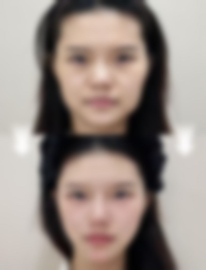八、成都武侯盼美整形医院真实的顾客评价如下: