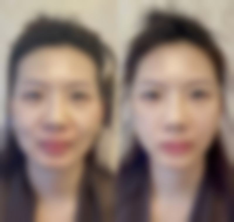五、东营市雅丰整形医院实例