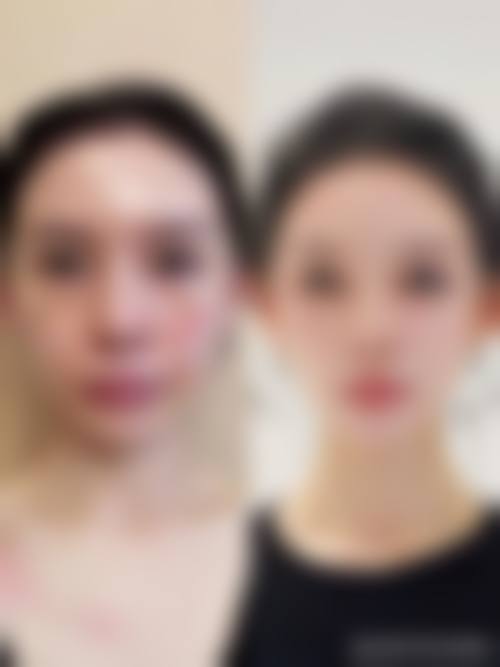 五、朝阳基恩医院医疗美容实例