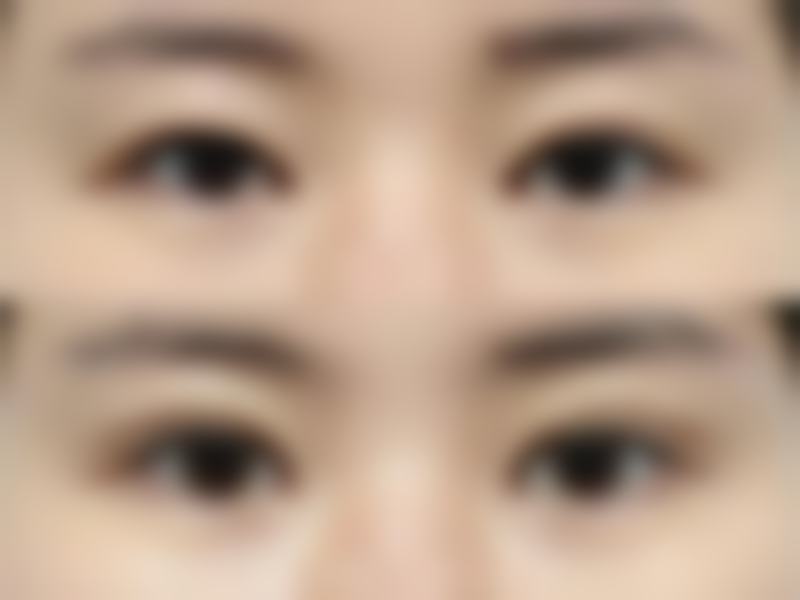 余双平医生实例