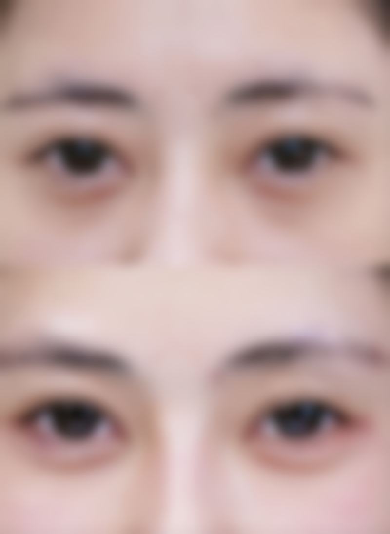 七、深圳美诚整形医院真实的顾客评价如下: