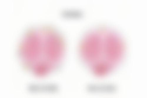 隆胸假体破裂会怎样?及时处理可修复