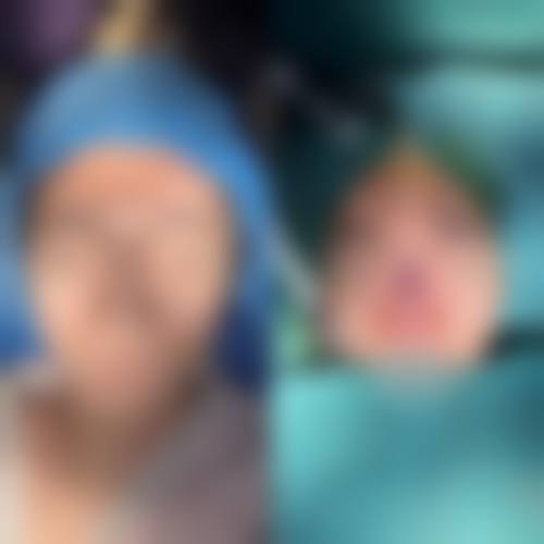 八、邢台沙河伊嘉医疗美容诊所真实的顾客评价如下: