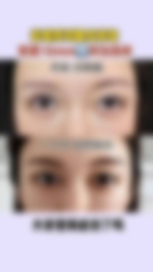 八、扬州市第一人民医院整形美容中 心真实的顾客评价如下: