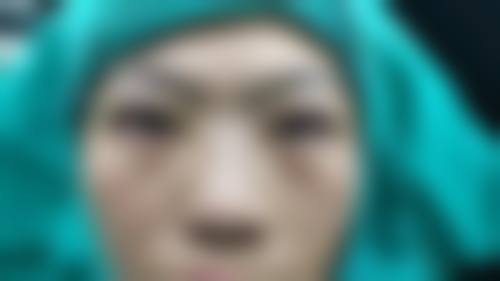 沈舒煜医生项目价格表参考