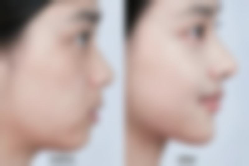 生姜为何能助力去眼袋？抗炎促循环，改善轻微水肿型眼袋与血管型黑眼圈 