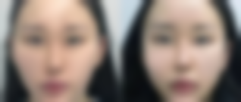 二、莆田新生植发医疗美容门诊部正规吗?来看看医院资质: