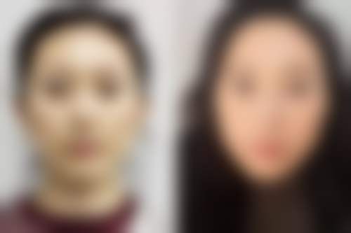 五、洛阳马宁医疗美容诊所实例