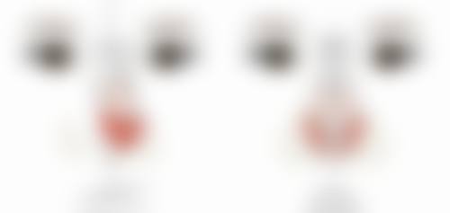 男士去眼袋之术前术后注意事项，保护成效特别重要
