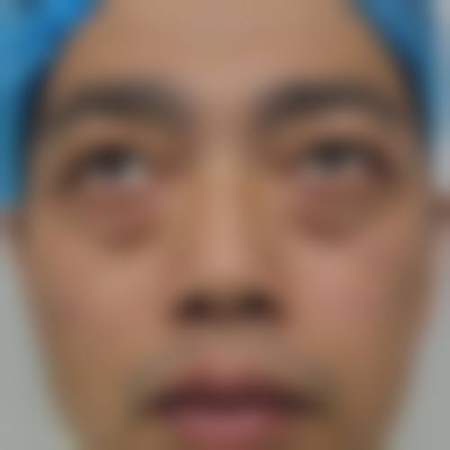 五、西安中 心医院烧伤整形科实例