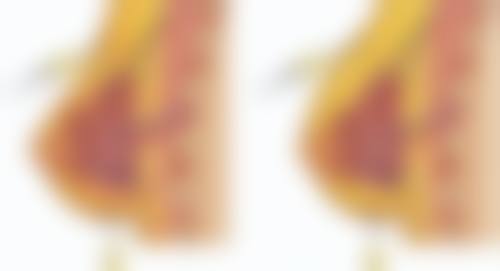 胸前痘痘留疤疙瘩去除:日常护理与随访