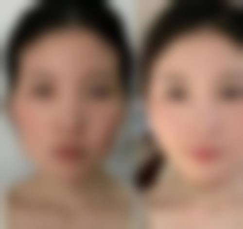 二、镇江润州瑞丽整形医院正规吗?来看看医院资质: