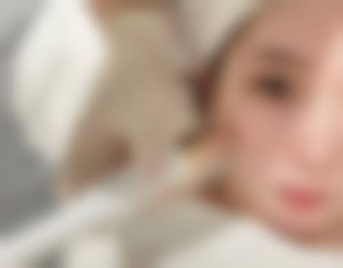 割双眼皮后眼睛闭不上咋办?长期重度情况这样应对