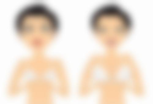 割双眼皮后眼睛闭不上咋办?术后注意事项要牢记