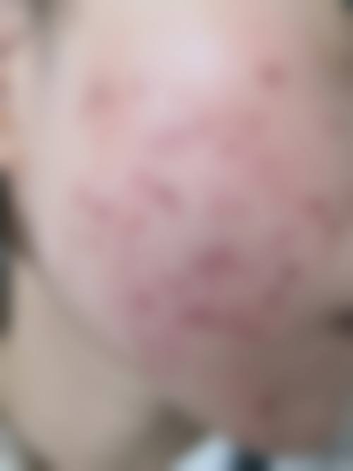 翟笃诚医生实例
