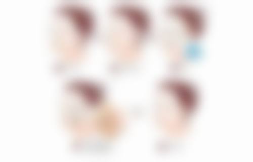 硅胶隆鼻危害知多少之假体透光/显形
