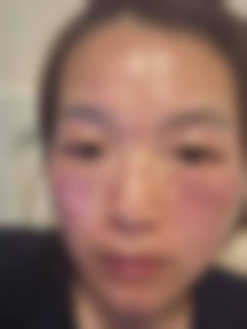 卢静薇医生怎么样可靠吗?